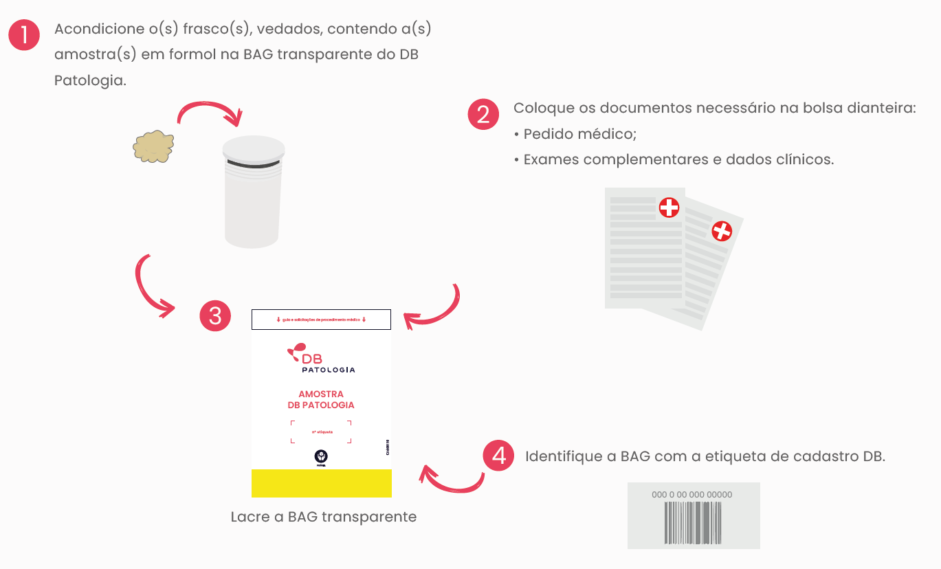 BIÓPSIA DE MEDULA ÓSSEA